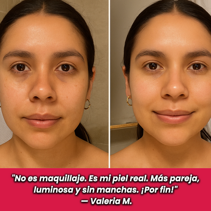 Anua | El Suero Coreano que Borra Manchas y Acné en 2 Semanas